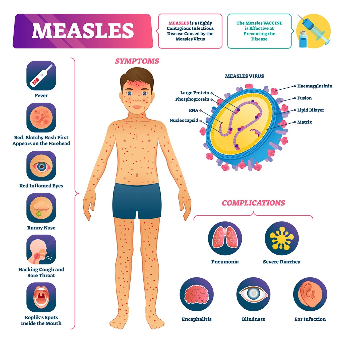 Graphic showing symptoms of measles